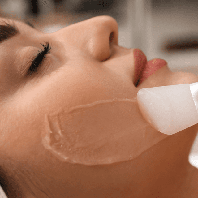 Chemical Peel Treatment Series